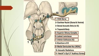 Brainstem Auditory Evoked Potentials | PPTX