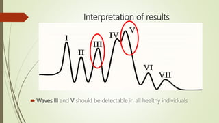Brainstem Auditory Evoked Potentials | PPTX