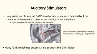 Brainstem Auditory Evoked Potentials Part II | PPTX