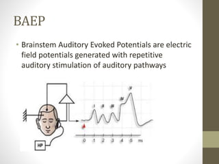 Brainstem auditory evoked response | PPTX