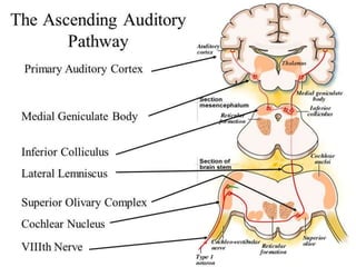 Brainstem auditory evoked response | PPTX
