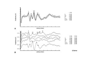 Brainstem auditory evoked responses (baer or abr | PPTX