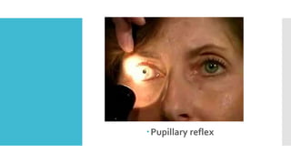Pupillary reflex
 