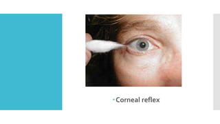 Corneal reflex
 