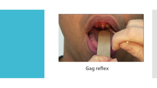 Gag reflex
 
