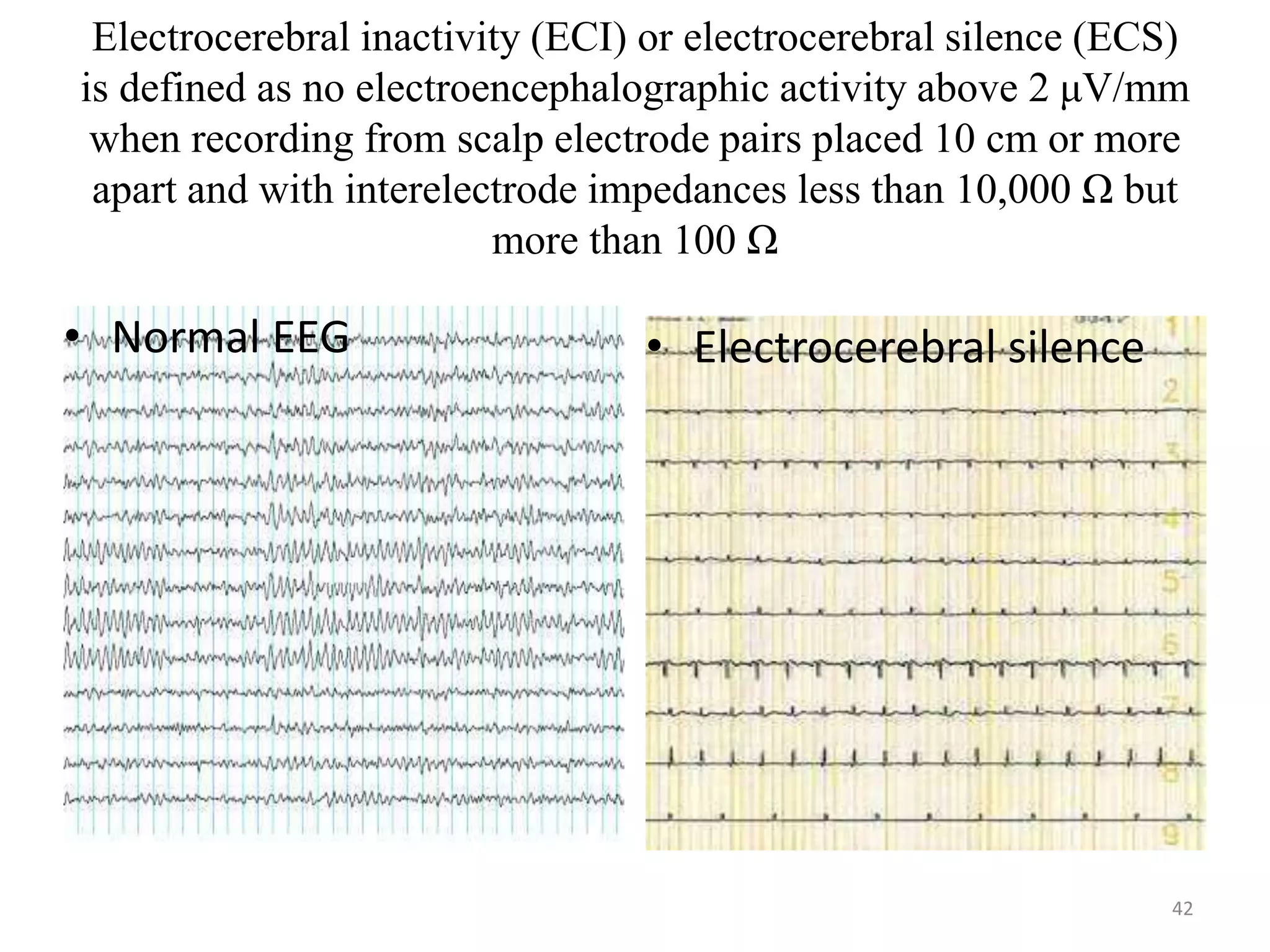 Electrocerebral inactivity (ECI) or electrocerebral silence (ECS)
is defined as no electroencephalographic activity above 2 μV/mm
when recording from scalp electrode pairs placed 10 cm or more
apart and with interelectrode impedances less than 10,000 Ω but
more than 100 Ω
• Normal EEG • Electrocerebral silence
42
 
