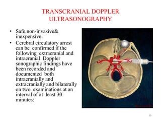 TRANSCRANIAL DOPPLER
ULTRASONOGRAPHY
• Safe,non-invasive&
inexpensive.
• Cerebral circulatory arrest
can be confirmed if the
following extracranial and
intracranial Doppler
sonographic findings have
been recorded and
documented both
intracranially and
extracranially and bilaterally
on two examinations at an
interval of at least 30
minutes:
39
 