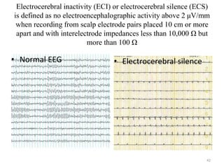 Electrocerebral inactivity (ECI) or electrocerebral silence (ECS)
is defined as no electroencephalographic activity above 2 μV/mm
when recording from scalp electrode pairs placed 10 cm or more
apart and with interelectrode impedances less than 10,000 Ω but
more than 100 Ω
• Normal EEG • Electrocerebral silence
42
 