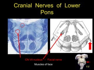 Cranial Nerves of Lower
Pons
CN VII nucleus - Facial nerve
Muscles of face
 