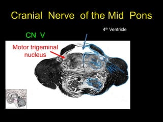 Cranial Nerve of the Mid Pons
4th Ventricle
CN V
Motor trigeminal
nucleus
 