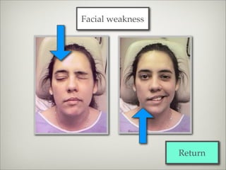 Facial weakness




                  Return
 