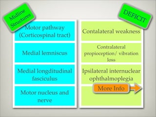 ne s
    li e
                                            DE
  id ur                                        FIC
M ct                                               I  T
S tru
        Motor pathway
                           Contalateral weakness
   (Corticospinal tract)

                                Contralateral
    Medial lemniscus       propioception/ vibration
                                     loss

  Medial longditudinal     Ipsilateral internuclear
      fasciculus              ophthalmoplegia
                                 More Info
   Motor nucleus and
         nerve
 