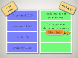 DE
 CN
4 ns
                                        FIC
                                            IT
 Po
                       Ipsilateral facial
   Trigeminal CN5
                         sensory loss

                         Ipsilateral eye
   Abducent CN6
                      abduction weakness
                         More Info
        Facial CN7


       Auditory CN8
 