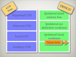 DE
 CN
4 ns
                                        FIC
                                            IT
 Po
                       Ipsilateral facial
   Trigeminal CN5
                         sensory loss

                         Ipsilateral eye
   Abducent CN6
                      abduction weakness

                       Ipsilateral facial
        Facial CN7
                          weakness
                         More Info
       Auditory CN8
 