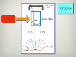RETURN


LESION         Brain stem




         10%   90%
 