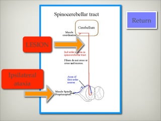Return


      LESION



Ipsilateral
  ataxia
 