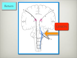 Return




         LESION
 