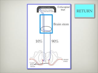 RETURN


      Brain stem




10%   90%
 