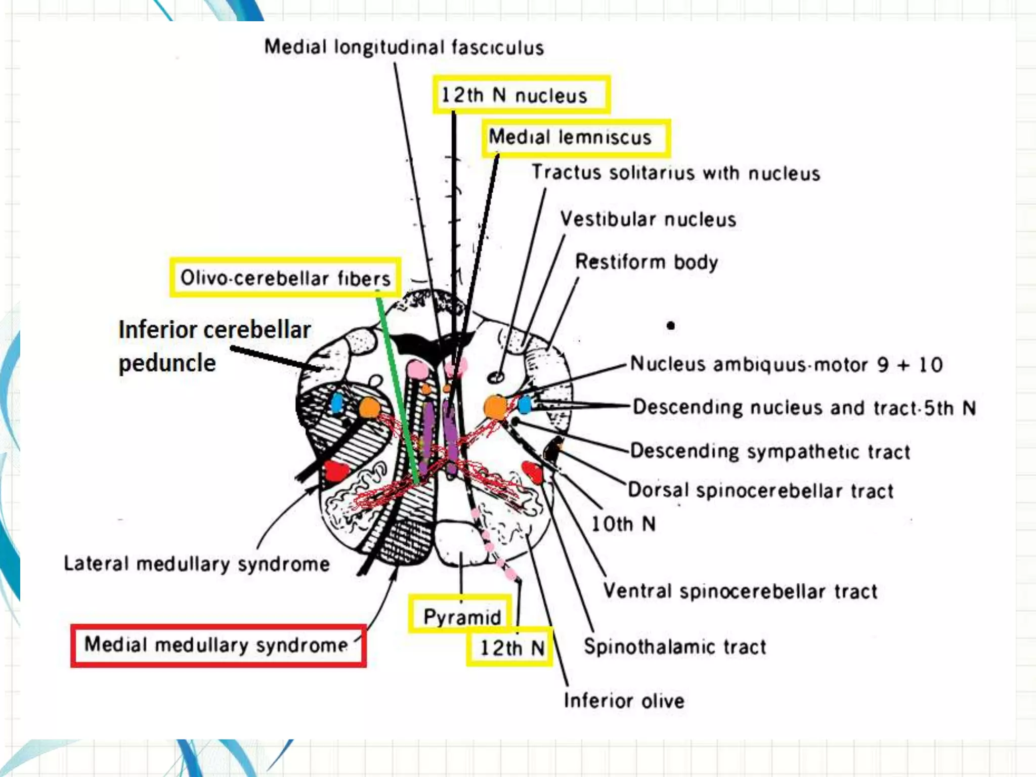 Brainstem stroke syndromes | PPTX