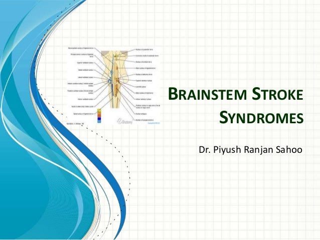 Stroke Syndromes Chart