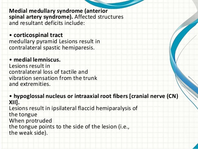 Brainstem stroke syndromes Brainstem stroke syndromes