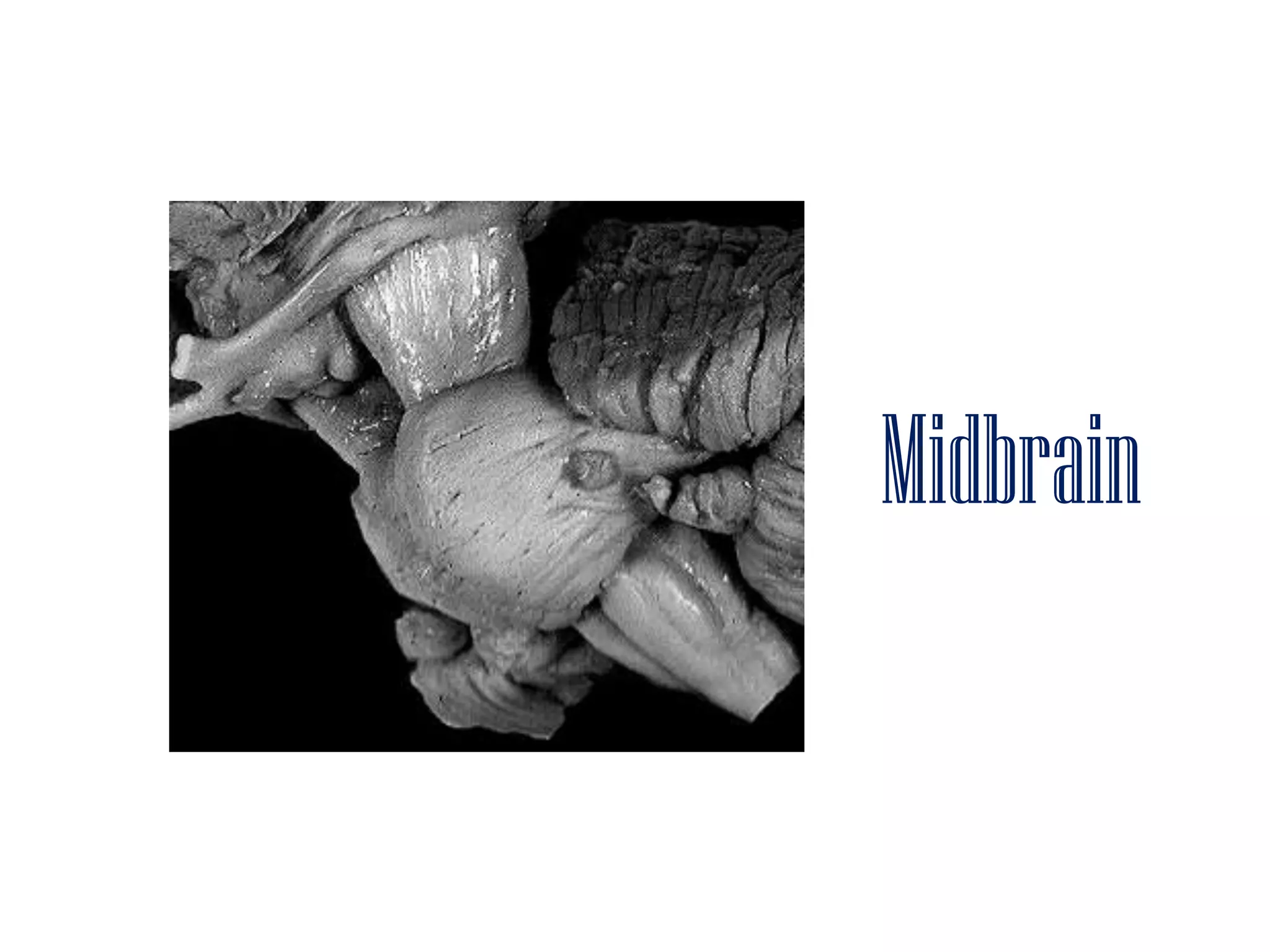 Midbrain
 