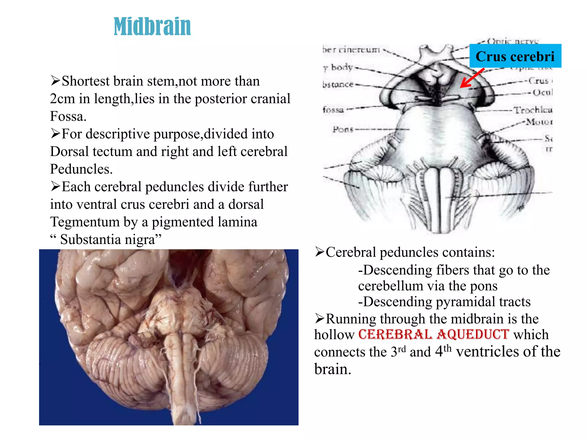 Midbrain
                                                                         Crus cerebri
Shortest brain stem,not more than
2cm in length,lies in the posterior cranial
Fossa.
For descriptive purpose,divided into
Dorsal tectum and right and left cerebral
Peduncles.
Each cerebral peduncles divide further
into ventral crus cerebri and a dorsal
Tegmentum by a pigmented lamina
“ Substantia nigra”
                                              Cerebral peduncles contains:
                                                     -Descending fibers that go to the
                                                     cerebellum via the pons
                                                     -Descending pyramidal tracts
                                              Running through the midbrain is the
                                              hollow cerebral aqueduct which
                                              connects the 3rd and 4th ventricles of the
                                              brain.
 