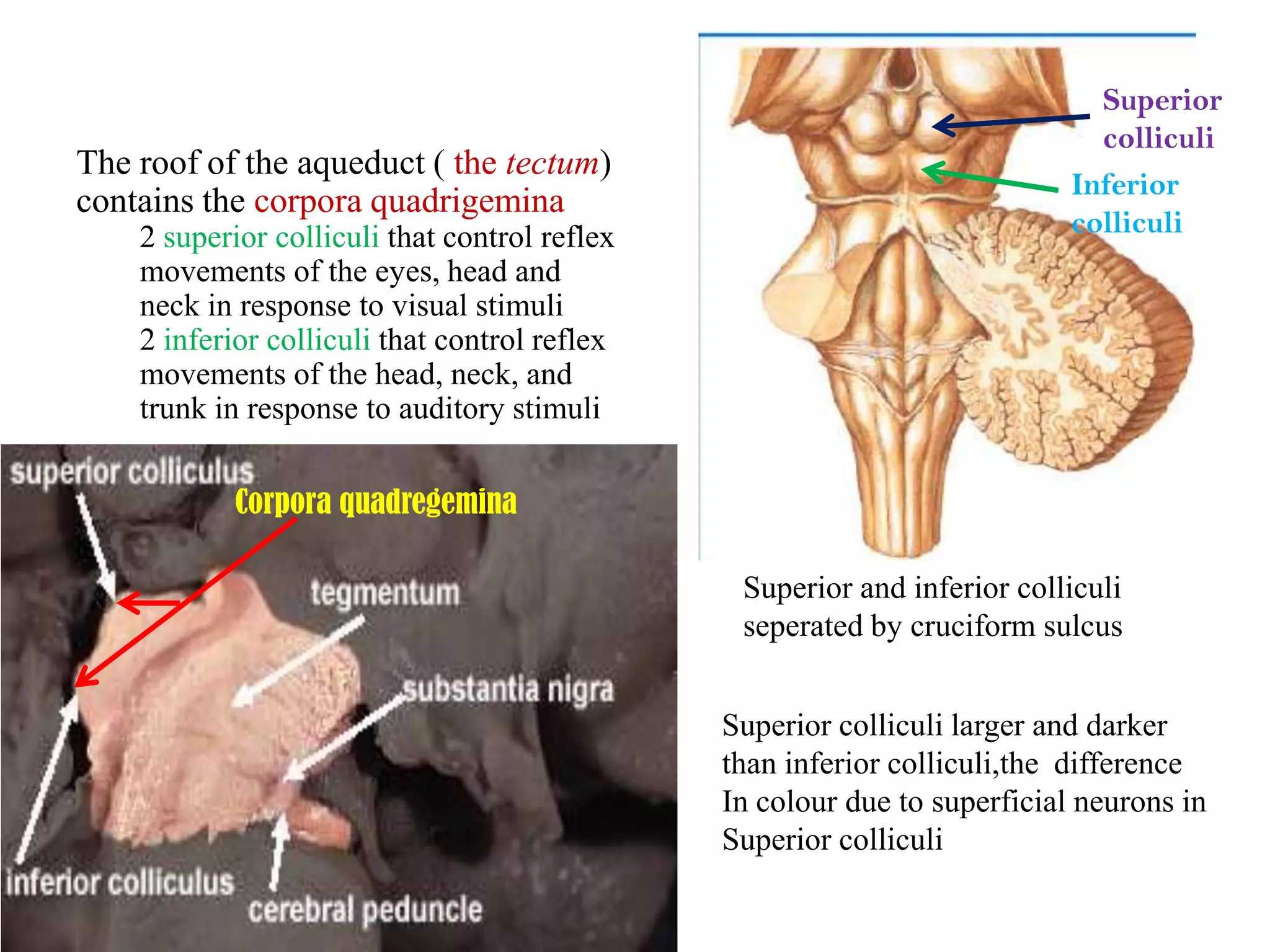 Superior
                                                                             colliculi
The roof of the aqueduct ( the tectum)
                                                                           Inferior
contains the corpora quadrigemina
    2 superior colliculi that control reflex                               colliculi
    movements of the eyes, head and
    neck in response to visual stimuli
    2 inferior colliculi that control reflex
    movements of the head, neck, and
    trunk in response to auditory stimuli


            Corpora quadregemina

                                                Superior and inferior colliculi
                                                seperated by cruciform sulcus


                                               Superior colliculi larger and darker
                                               than inferior colliculi,the difference
                                               In colour due to superficial neurons in
                                               Superior colliculi
 
