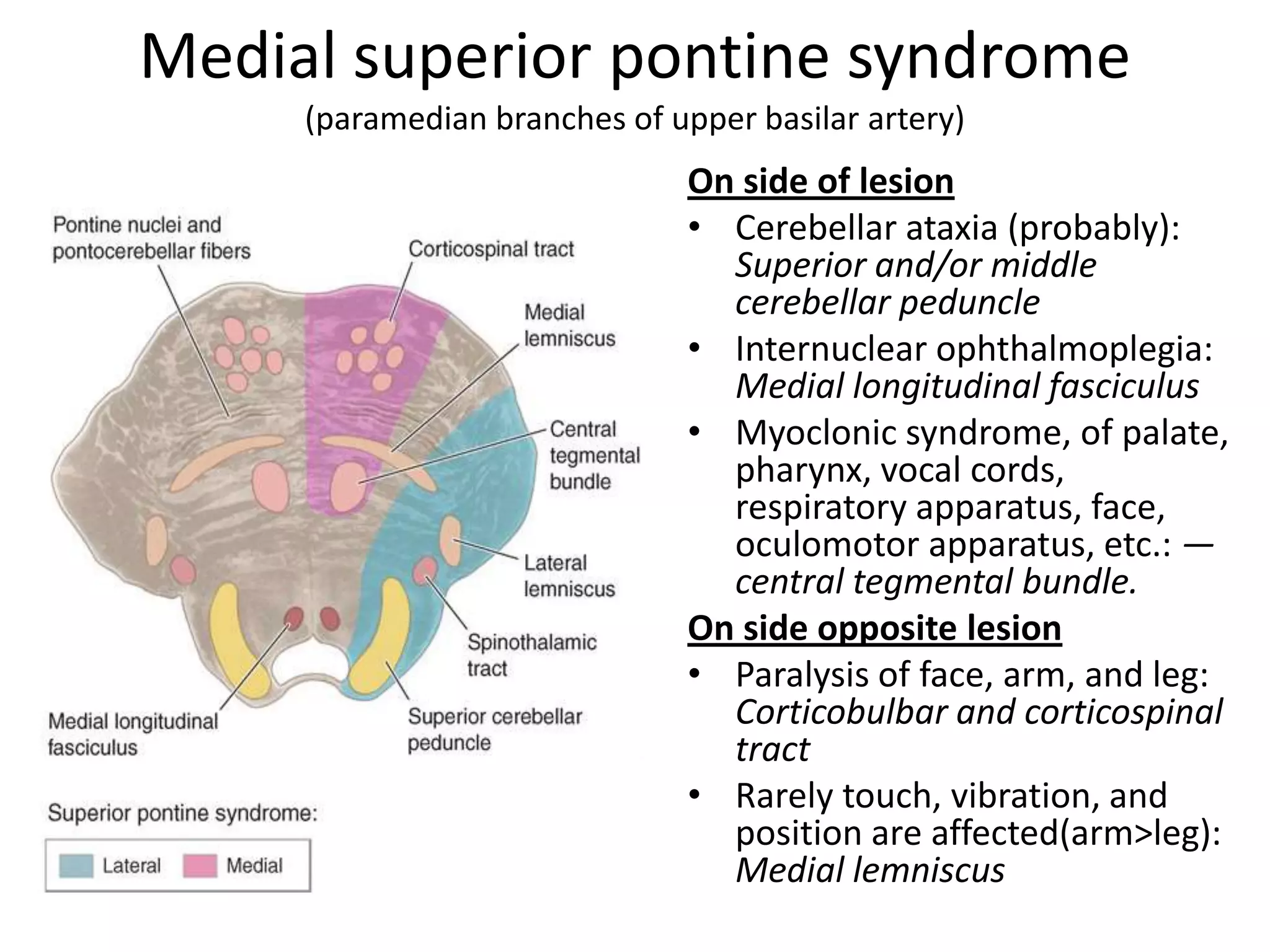 Medial superior pontine syndrome
     (paramedian branches of upper basilar artery)
                               On side of lesion
                               • Cerebellar ataxia (probably):
                                 Superior and/or middle
                                 cerebellar peduncle
                               • Internuclear ophthalmoplegia:
                                 Medial longitudinal fasciculus
                               • Myoclonic syndrome, of palate,
                                 pharynx, vocal cords,
                                 respiratory apparatus, face,
                                 oculomotor apparatus, etc.: —
                                 central tegmental bundle.
                               On side opposite lesion
                               • Paralysis of face, arm, and leg:
                                 Corticobulbar and corticospinal
                                 tract
                               • Rarely touch, vibration, and
                                 position are affected(arm>leg):
                                 Medial lemniscus
 