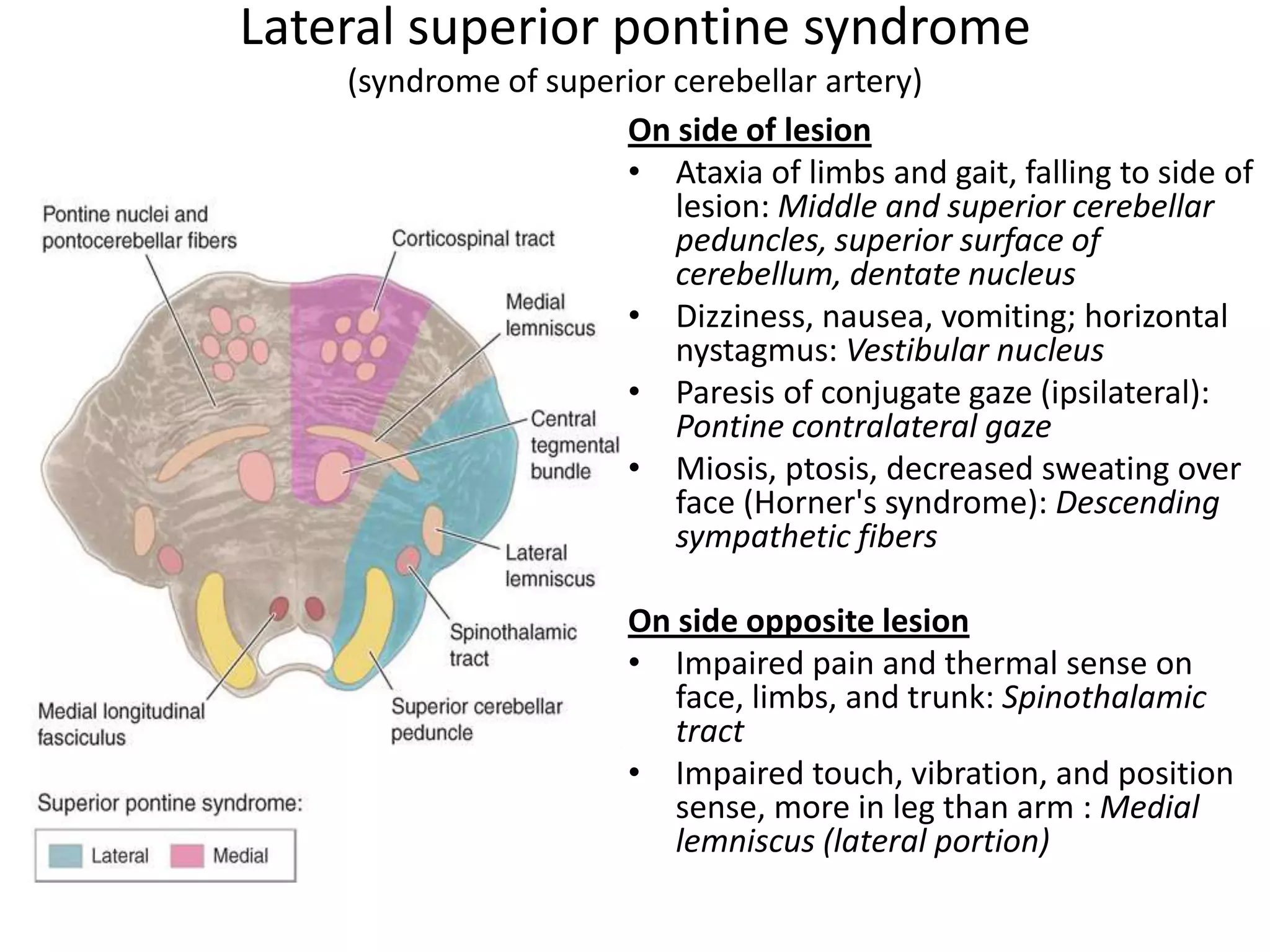 Lateral superior pontine syndrome
    (syndrome of superior cerebellar artery)
                      On side of lesion
                      • Ataxia of limbs and gait, falling to side of
                          lesion: Middle and superior cerebellar
                          peduncles, superior surface of
                          cerebellum, dentate nucleus
                      • Dizziness, nausea, vomiting; horizontal
                          nystagmus: Vestibular nucleus
                      • Paresis of conjugate gaze (ipsilateral):
                          Pontine contralateral gaze
                      • Miosis, ptosis, decreased sweating over
                          face (Horner's syndrome): Descending
                          sympathetic fibers

                       On side opposite lesion
                       • Impaired pain and thermal sense on
                          face, limbs, and trunk: Spinothalamic
                          tract
                       • Impaired touch, vibration, and position
                          sense, more in leg than arm : Medial
                          lemniscus (lateral portion)
 