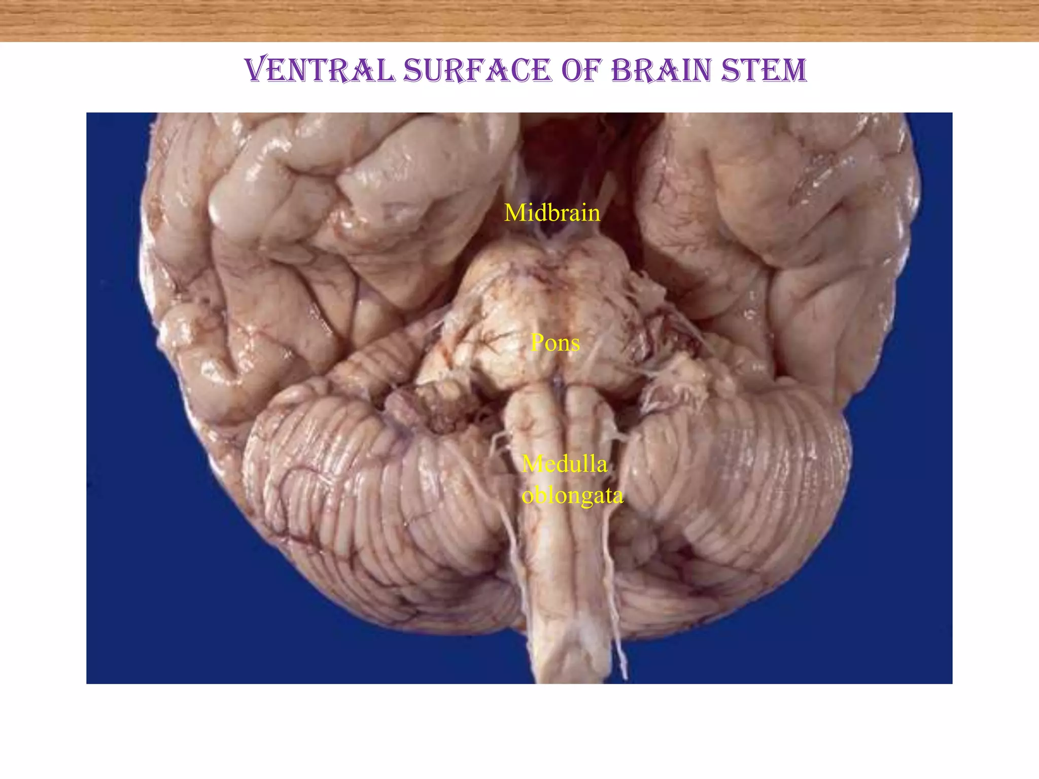 Ventral surface of brain stem



             Midbrain




               Pons



              Medulla
              oblongata
 