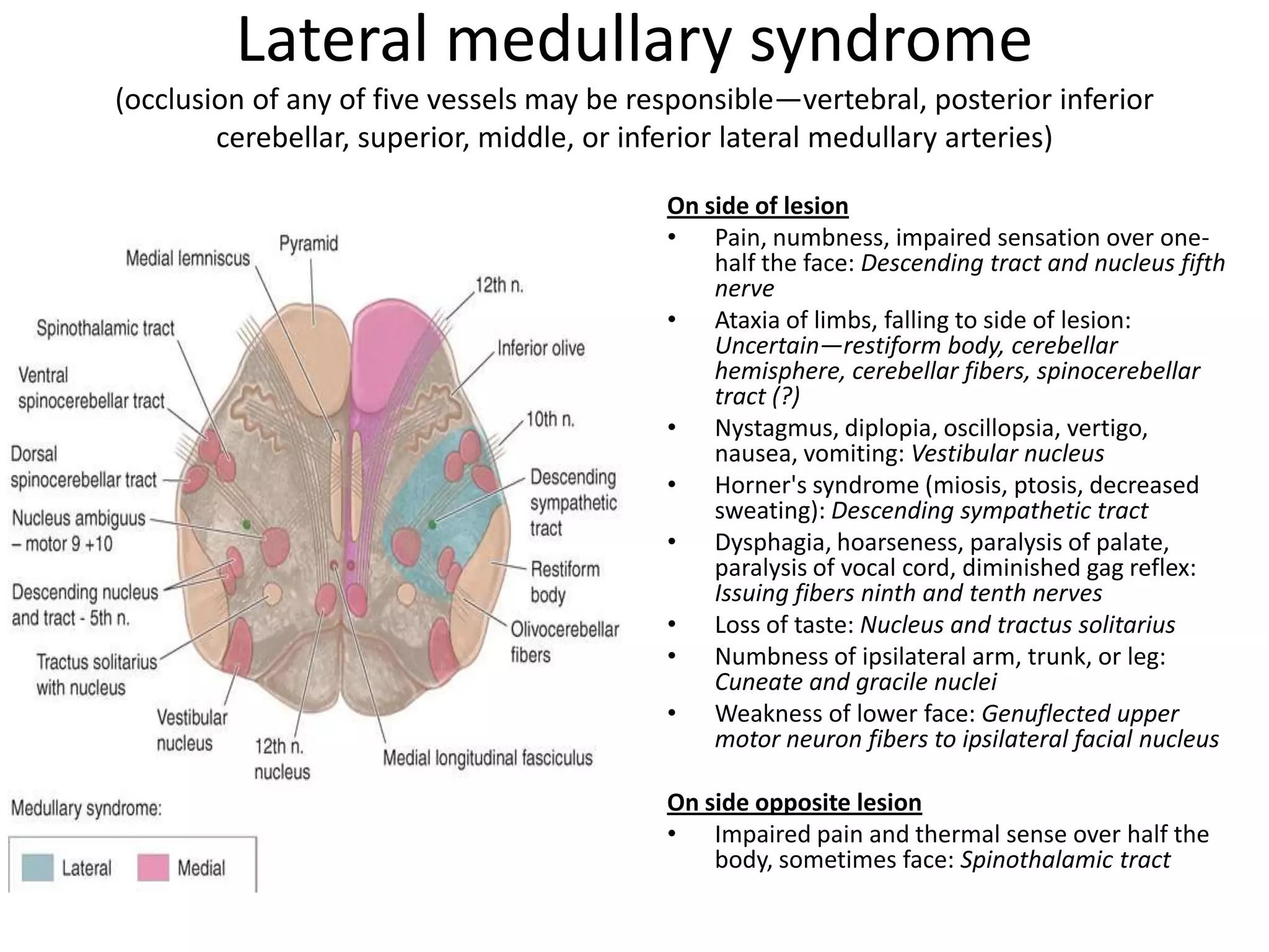 Lateral medullary syndrome
(occlusion of any of five vessels may be responsible—vertebral, posterior inferior
        cerebellar, superior, middle, or inferior lateral medullary arteries)

                                           On side of lesion
                                           • Pain, numbness, impaired sensation over one-
                                               half the face: Descending tract and nucleus fifth
                                               nerve
                                           • Ataxia of limbs, falling to side of lesion:
                                               Uncertain—restiform body, cerebellar
                                               hemisphere, cerebellar fibers, spinocerebellar
                                               tract (?)
                                           • Nystagmus, diplopia, oscillopsia, vertigo,
                                               nausea, vomiting: Vestibular nucleus
                                           • Horner's syndrome (miosis, ptosis, decreased
                                               sweating): Descending sympathetic tract
                                           • Dysphagia, hoarseness, paralysis of palate,
                                               paralysis of vocal cord, diminished gag reflex:
                                               Issuing fibers ninth and tenth nerves
                                           • Loss of taste: Nucleus and tractus solitarius
                                           • Numbness of ipsilateral arm, trunk, or leg:
                                               Cuneate and gracile nuclei
                                           • Weakness of lower face: Genuflected upper
                                               motor neuron fibers to ipsilateral facial nucleus

                                           On side opposite lesion
                                           • Impaired pain and thermal sense over half the
                                               body, sometimes face: Spinothalamic tract
 