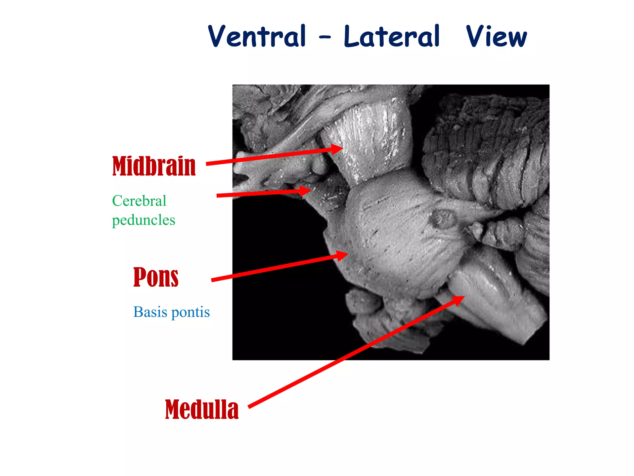 Ventral – Lateral View



Midbrain
Cerebral
peduncles


  Pons
  Basis pontis




       Medulla
 