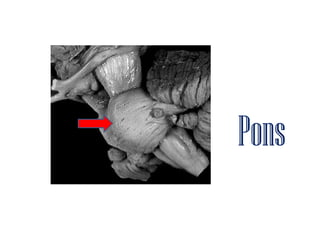 Brainstem stroke syndromes ppt | PPTX