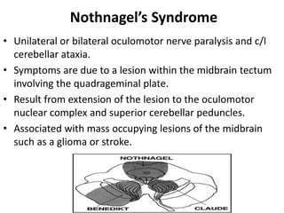 Nothnagel’s Syndrome
• Unilateral or bilateral oculomotor nerve paralysis and c/l
cerebellar ataxia.
• Symptoms are due to a lesion within the midbrain tectum
involving the quadrageminal plate.
• Result from extension of the lesion to the oculomotor
nuclear complex and superior cerebellar peduncles.
• Associated with mass occupying lesions of the midbrain
such as a glioma or stroke.
 