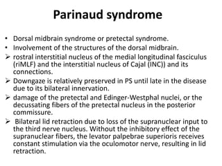 Parinaud syndrome
• Dorsal midbrain syndrome or pretectal syndrome.
• Involvement of the structures of the dorsal midbrain.
 rostral interstitial nucleus of the medial longitudinal fasciculus
(riMLF) and the interstitial nucleus of Cajal (INC)) and its
connections.
 Downgaze is relatively preserved in PS until late in the disease
due to its bilateral innervation.
 damage of the pretectal and Edinger-Westphal nuclei, or the
decussating fibers of the pretectal nucleus in the posterior
commissure.
 Bilateral lid retraction due to loss of the supranuclear input to
the third nerve nucleus. Without the inhibitory effect of the
supranuclear fibers, the levator palpebrae superioris receives
constant stimulation via the oculomotor nerve, resulting in lid
retraction.
 