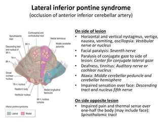 Lateral inferior pontine syndrome
(occlusion of anterior inferior cerebellar artery)
On side of lesion
• Horizontal and vertical nystagmus, vertigo,
nausea, vomiting, oscillopsia: Vestibular
nerve or nucleus
• Facial paralysis: Seventh nerve
• Paralysis of conjugate gaze to side of
lesion: Center for conjugate lateral gaze
• Deafness, tinnitus: Auditory nerve or
cochlear nucleus
• Ataxia: Middle cerebellar peduncle and
cerebellar hemisphere
• Impaired sensation over face: Descending
tract and nucleus fifth nerve
On side opposite lesion
• Impaired pain and thermal sense over
one-half the body (may include face):
Spinothalamic tract
 
