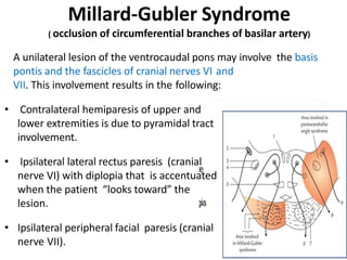 Millard-Gubler Syndrome
( occlusion of circumferential branches of basilar artery)
A unilateral lesion of the ventrocaudal pons may involve the basis
pontis and the fascicles of cranial nerves VI and
VII. This involvement results in the following:
• Contralateral hemiparesis of upper and
lower extremities is due to pyramidal tract
involvement.
• Ipsilateral lateral rectus paresis (cranial
nerve VI) with diplopia that is accentuated
when the patient “looks toward” the
lesion.
• Ipsilateral peripheral facial paresis (cranial
nerve VII).
 