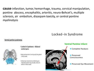 cause-infarction, tumor, hemorrhage, trauma, cervical manipulation,
pontine abscess, encephalitis, arteritis, neuro-Behcet’s, multiple
sclerosis, air embolism, diazepam toxicity, or central pontine
myelinolysis
 