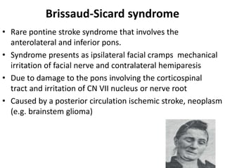 Brissaud-Sicard syndrome
• Rare pontine stroke syndrome that involves the
anterolateral and inferior pons.
• Syndrome presents as ipsilateral facial cramps mechanical
irritation of facial nerve and contralateral hemiparesis
• Due to damage to the pons involving the corticospinal
tract and irritation of CN VII nucleus or nerve root
• Caused by a posterior circulation ischemic stroke, neoplasm
(e.g. brainstem glioma)
 