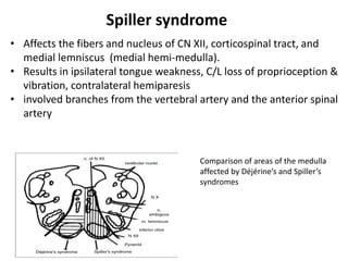 Comparison of areas of the medulla
affected by Déjérine’s and Spiller’s
syndromes
• Affects the fibers and nucleus of CN XII, corticospinal tract, and
medial lemniscus (medial hemi-medulla).
• Results in ipsilateral tongue weakness, C/L loss of proprioception &
vibration, contralateral hemiparesis
• involved branches from the vertebral artery and the anterior spinal
artery
Spiller syndrome
 