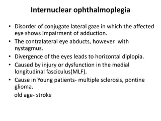 Internuclear ophthalmoplegia
• Disorder of conjugate lateral gaze in which the affected
eye shows impairment of adduction.
• The contralateral eye abducts, however with
nystagmus.
• Divergence of the eyes leads to horizontal diplopia.
• Caused by injury or dysfunction in the medial
longitudinal fasciculus(MLF).
• Cause in Young patients- multiple sclerosis, pontine
glioma.
old age- stroke
 