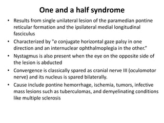 One and a half syndrome
• Results from single unilateral lesion of the paramedian pontine
reticular formation and the ipsilateral medial longitudinal
fasciculus
• Characterized by "a conjugate horizontal gaze palsy in one
direction and an internuclear ophthalmoplegia in the other.”
• Nystagmus is also present when the eye on the opposite side of
the lesion is abducted
• Convergence is classically spared as cranial nerve III (oculomotor
nerve) and its nucleus is spared bilaterally.
• Cause include pontine hemorrhage, ischemia, tumors, infective
mass lesions such as tuberculomas, and demyelinating conditions
like multiple sclerosis
 