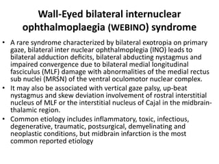 Wall-Eyed bilateral internuclear
ophthalmoplaegia (WEBINO) syndrome
• A rare syndrome characterized by bilateral exotropia on primary
gaze, bilateral inter nuclear ophthalmoplegia (INO) leads to
bilateral adduction deﬁcits, bilateral abducting nystagmus and
impaired convergence due to bilateral medial longitudinal
fasciculus (MLF) damage with abnormalities of the medial rectus
sub nuclei (MRSN) of the ventral oculomotor nuclear complex.
• It may also be associated with vertical gaze palsy, up-beat
nystagmus and skew deviation involvement of rostral interstitial
nucleus of MLF or the interstitial nucleus of Cajal in the midbrain-
thalamic region.
• Common etiology includes inflammatory, toxic, infectious,
degenerative, traumatic, postsurgical, demyelinating and
neoplastic conditions, but midbrain infarction is the most
common reported etiology
 