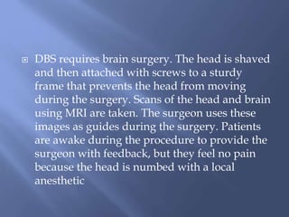  DBS requires brain surgery. The head is shaved
and then attached with screws to a sturdy
frame that prevents the head from moving
during the surgery. Scans of the head and brain
using MRI are taken. The surgeon uses these
images as guides during the surgery. Patients
are awake during the procedure to provide the
surgeon with feedback, but they feel no pain
because the head is numbed with a local
anesthetic
 