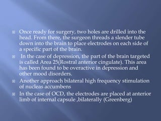  Once ready for surgery, two holes are drilled into the
head. From there, the surgeon threads a slender tube
down into the brain to place electrodes on each side of
a specific part of the brain.
 In the case of depression, the part of the brain targeted
is called Area 25(Rostral anterior cingulate). This area
has been found to be overactive in depression and
other mood disorders.
 Another approach bilateral high frequency stimulation
of nucleas accumbens
 In the case of OCD, the electrodes are placed at anterior
limb of internal capsule ,bilaterally (Greenberg)
 
