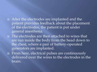  After the electrodes are implanted and the
patient provides feedback about the placement
of the electrodes, the patient is put under
general anesthesia.
 The electrodes are then attached to wires that
are run inside the body from the head down to
the chest, where a pair of battery-operated
generators are implanted.
 From here, electrical pulses are continuously
delivered over the wires to the electrodes in the
brain.
 