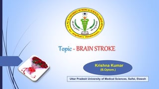 Krishna Kumar
(B.Optom.)
Uttar Pradesh University of Medical Sciences, Saifai, Etawah
 