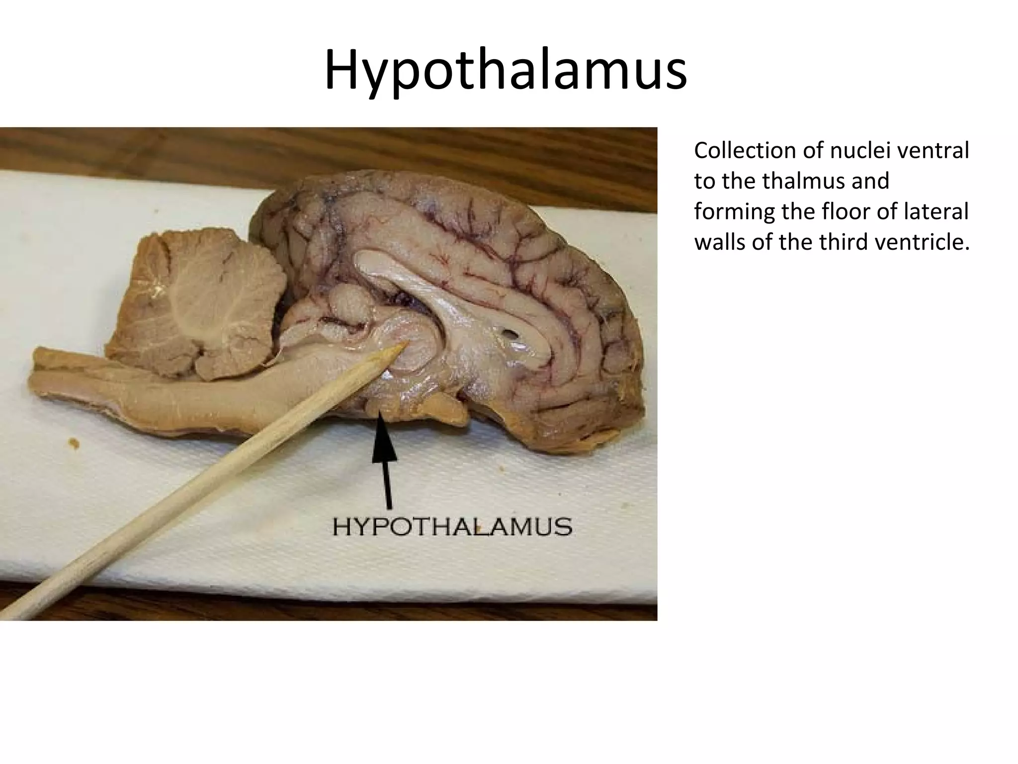 Hypothalamus
Collection of nuclei ventral
to the thalmus and
forming the floor of lateral
walls of the third ventricle.
 