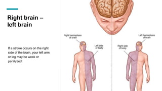 Right brain –
left brain
If a stroke occurs on the right
side of the brain, your left arm
or leg may be weak or
paralyzed.
 